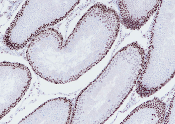 MSH6 Recombinant Rabbit Monoclonal Antibody