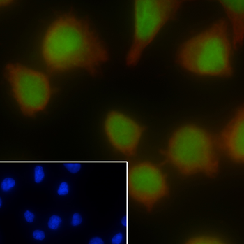 SOX-10 Recombinant Rabbit Monoclonal Antibody