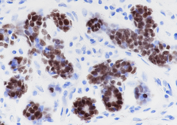 SOX-10 Recombinant Rabbit Monoclonal Antibody