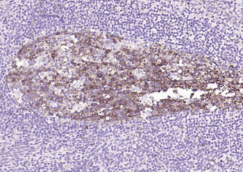 STMN1 Recombinant Rabbit Monoclonal Antibody