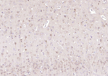 STMN1 Recombinant Rabbit Monoclonal Antibody