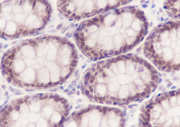 CDX2 Recombinant Rabbit Monoclonal Antibody