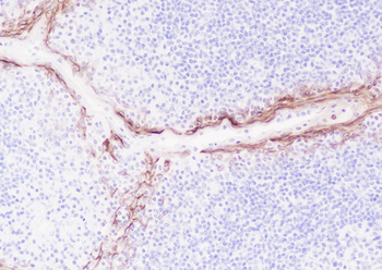 LYPD3 Recombinant Rabbit Monoclonal Antibody