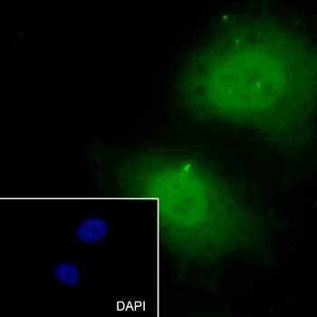 Caldesmon Recombinant Rabbit Monoclonal Antibody