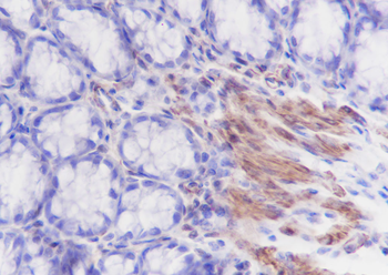 Caldesmon Recombinant Rabbit Monoclonal Antibody