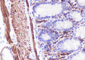 Caldesmon Recombinant Rabbit Monoclonal Antibody