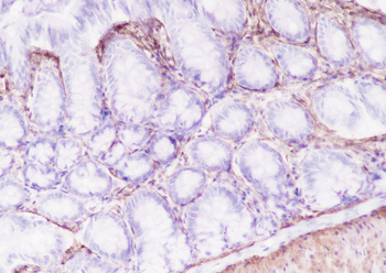 Caldesmon Recombinant Rabbit Monoclonal Antibody