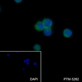HLA-DPA1 Recombinant Rabbit Monoclonal Antibody