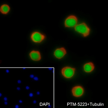IKZF1 Recombinant Rabbit Monoclonal Antibody