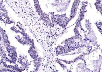 Phospho-GSK-3 Beta (Ser9) Mouse Monoclonal Antibody