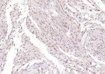 Phospho-GSK-3 Beta (Ser9) Mouse Monoclonal Antibody