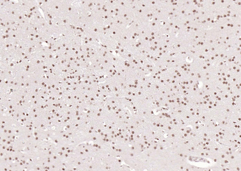 Phospho-GSK-3 Beta (Ser9) Mouse Monoclonal Antibody