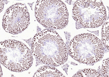 Phospho-GSK-3 Beta (Ser9) Mouse Monoclonal Antibody