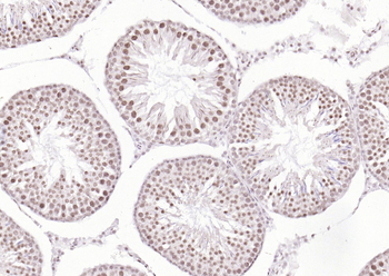 Phospho-GSK-3 Beta (Ser9) Mouse Monoclonal Antibody