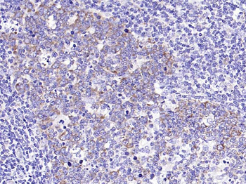 IL-6R alpha Rabbit Polyclonal Antibody