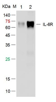 IL-6R alpha antibody