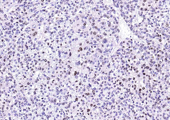 Arginase 1 Recombinant Rabbit Monoclonal Antibody