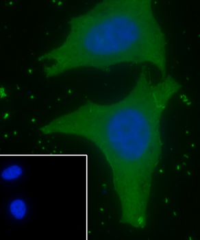 WNT10B Recombinant Mouse Monoclonal Antibody
