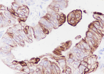 CK-7 Recombinant Rabbit Monoclonal Antibody