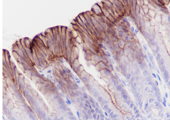 Phospho-Girdin (Tyr1765) Recombinant Rabbit Monoclonal Antibody