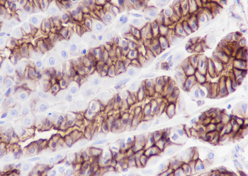 Phospho-Girdin (Tyr1765) Recombinant Rabbit Monoclonal Antibody