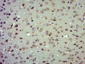 C11ORF46 Rabbit Polyclonal Antibody