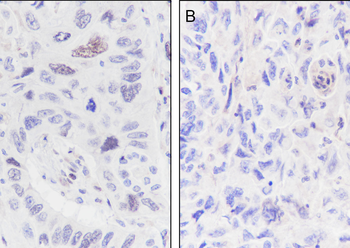 Ubiquityl-Histone H2B (Lys120) Recombinant Rabbit Monoclonal Antibody