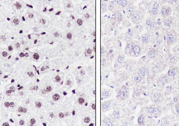 Ubiquityl-Histone H2B (Lys120) Recombinant Rabbit Monoclonal Antibody