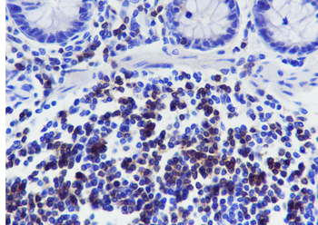 CD3G Recombinant Rabbit Monoclonal Antibody
