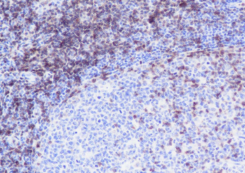 CD3G Recombinant Rabbit Monoclonal Antibody