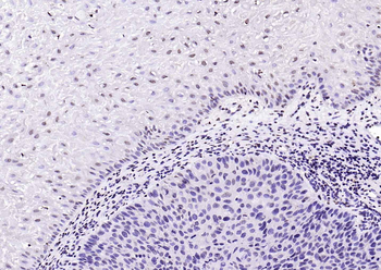 PML Rabbit Polyclonal Antibody