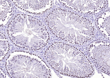 PML Rabbit Polyclonal Antibody