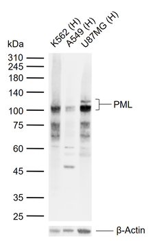 PML Rabbit Polyclonal Antibody