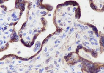 CYP11A1 Recombinant Mouse Monoclonal Antibody