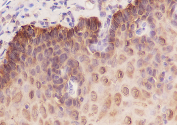 14-3-3 sigma Recombinant Mouse Monoclonal Antibody