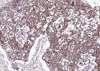 ALDH1A1 Recombinant Rabbit Monoclonal Antibody
