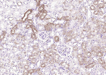 ALDH1A1 Recombinant Rabbit Monoclonal Antibody
