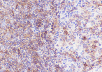 HLA-DPB1 Recombinant Rabbit Monoclonal Antibody