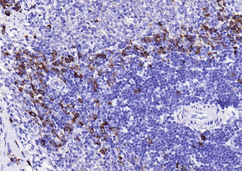JCHAIN Recombinant Rabbit Monoclonal Antibody