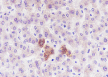 PDPK1 Recombinant Rabbit Monoclonal Antibody