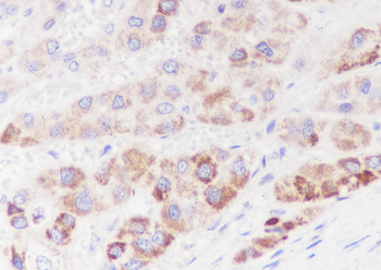 PDPK1 Recombinant Rabbit Monoclonal Antibody