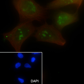 AATF Recombinant Rabbit Monoclonal Antibody