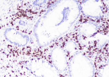 CD2 Recombinant Rabbit Monoclonal Antibody