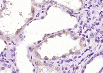 Ferritin Light Chain Rabbit Polyclonal Antibody
