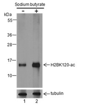 Histone H2B (Acetyl K120) Rabbit Polyclonal Antibody