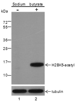 Histone H2B (Acetyl K5) Mouse Monoclonal Antibody