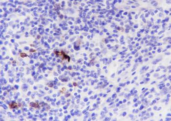 CD134 Recombinant Rabbit Monoclonal Antibody