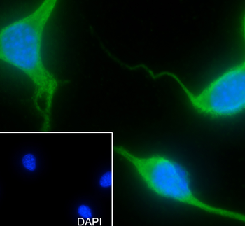 RPSA Recombinant Rabbit Monoclonal Antibody