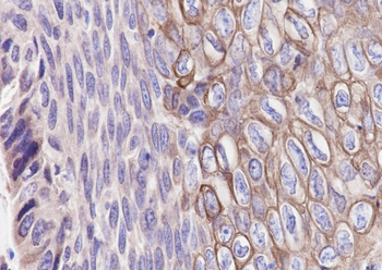 Keratin 1 Rabbit Polyclonal Antibody