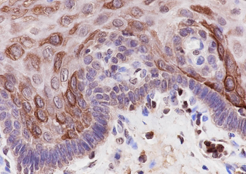 Keratin 1 Rabbit Polyclonal Antibody